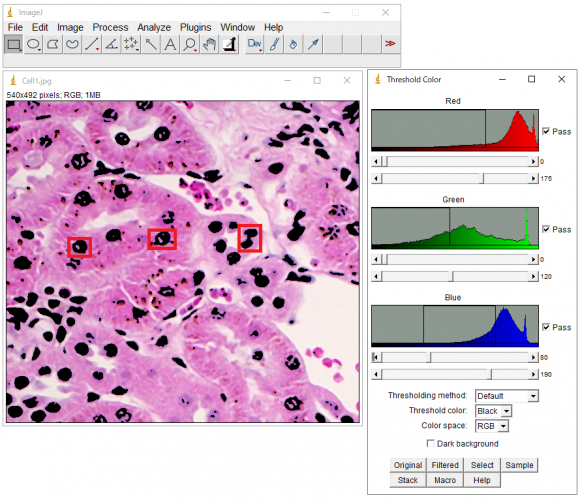 ImageJで細胞画像の解析してみました　～応用編～